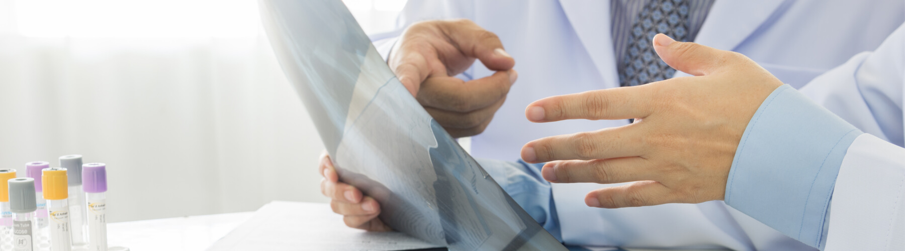 Doctor and patient looking at an x-ray, diagnosing peritoneal mesothelioma