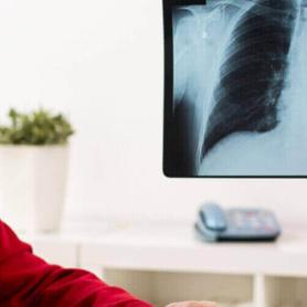 doctor showing lung xray to elderly couple with possible asbestos exposure